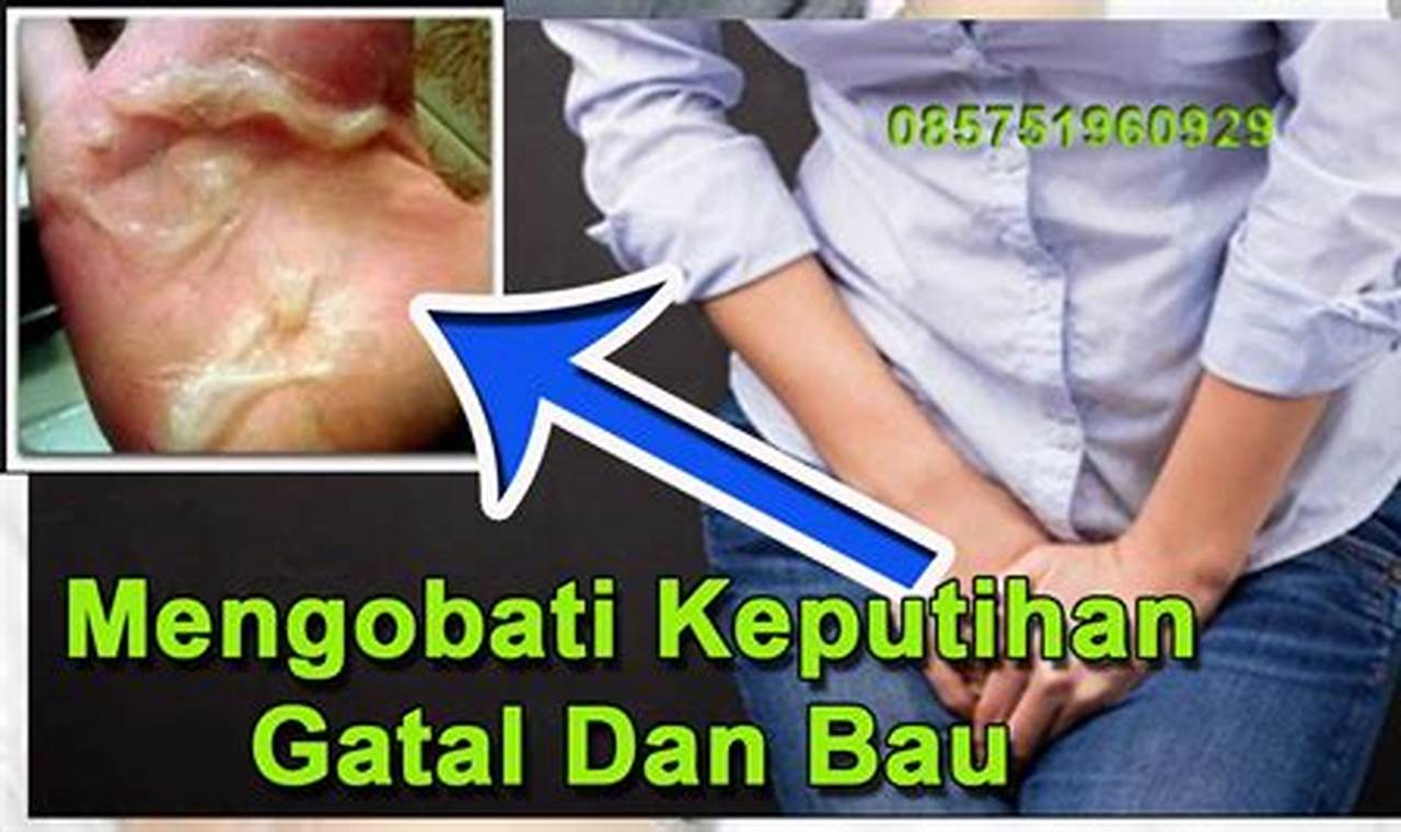 cara mengatasi keputihan bau